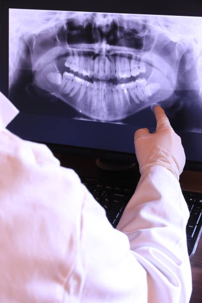Best Emergency Dental Care for Broken or Chipped Teeth in Oak Grove, MS