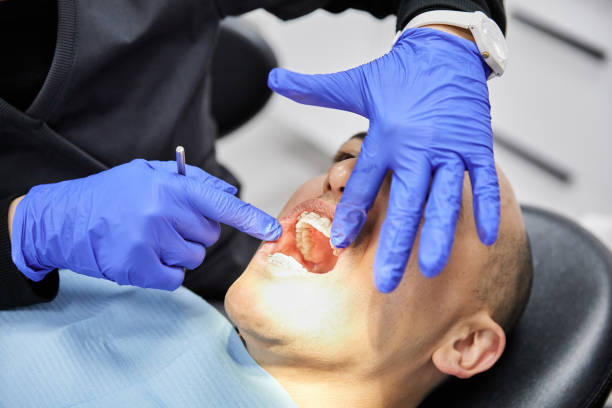 Best Emergency Treatment for Dental Infections or Abscesses in Oak Grove, MS